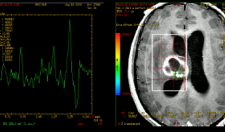 Espectroscopía